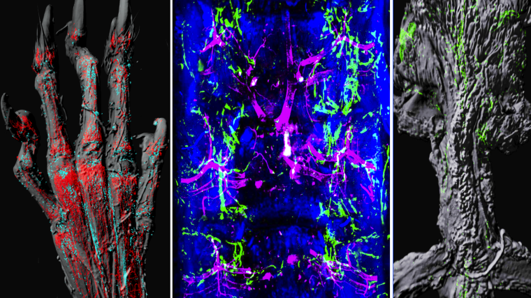 3D light sheet imaging of bones showing lymphatic and blood vasculature in a hand, vertebral column and sternum