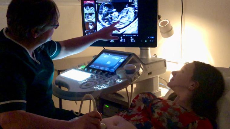 Woman having an ultrasound scan performed by Professor Sally Collins