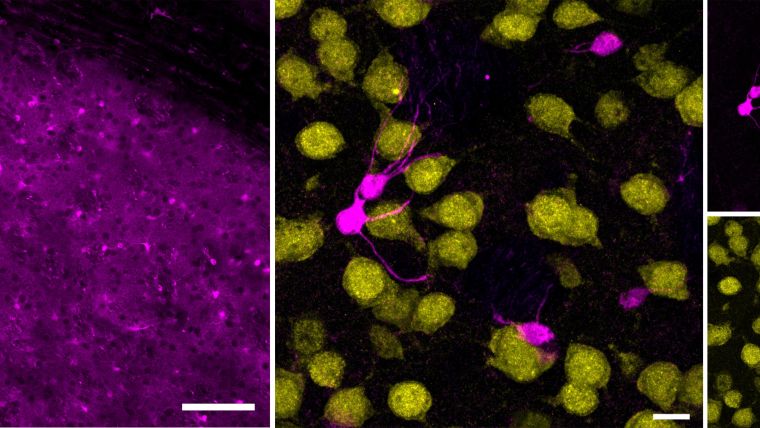 Showing striatal immunofluorescence signals for astrocyte marker S100β and neuronal marker NeuN