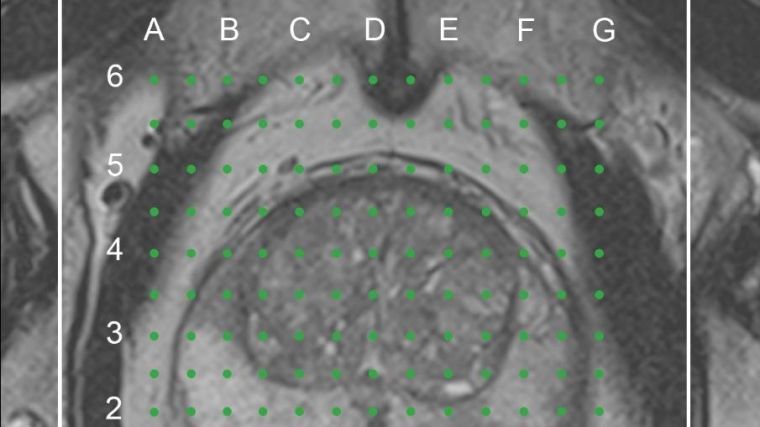 Example of a dataset from the Prostate MRI Imaging Study