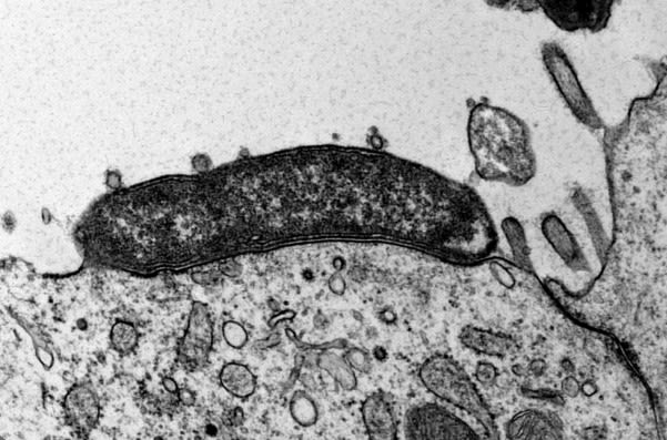 Helicobacter pylori infecting a human healthy gastric cell